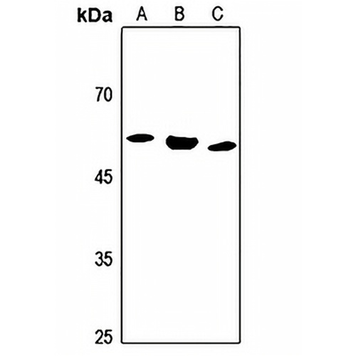 ALDH1B1 Rabbit Polyclonal Antibody