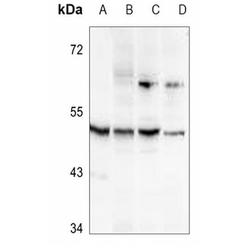 ALDH3B2 Rabbit Polyclonal Antibody