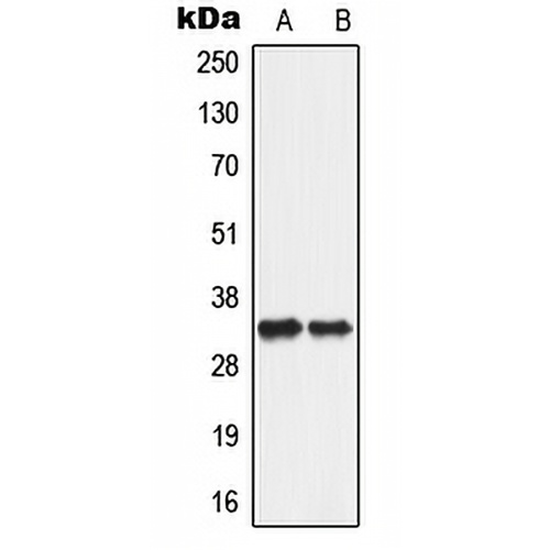 ANT2 Rabbit Polyclonal Antibody