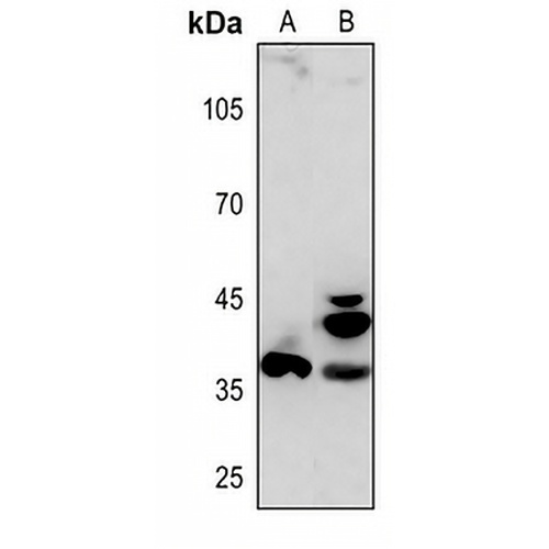 APAF-1-ALT Rabbit Polyclonal Antibody