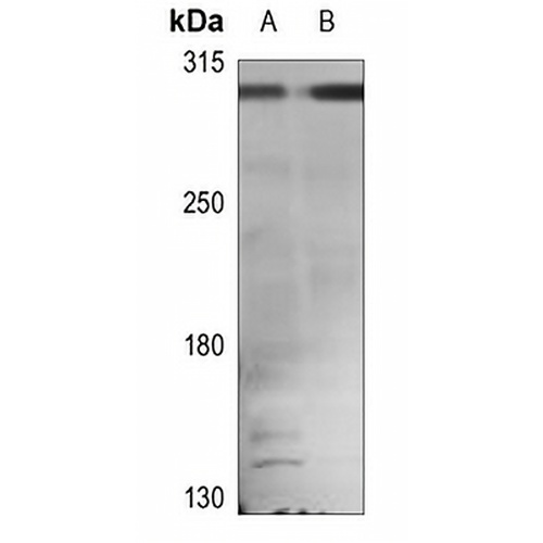 APC Rabbit Polyclonal Antibody