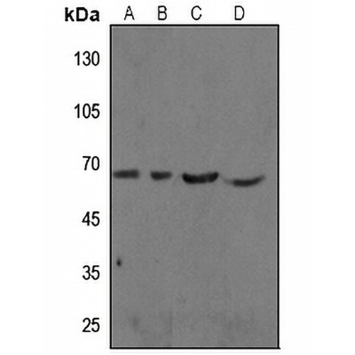 cIAP1 Rabbit Polyclonal Antibody