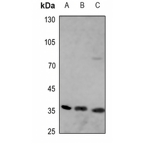 Apolipoprotein E Rabbit Polyclonal Antibody