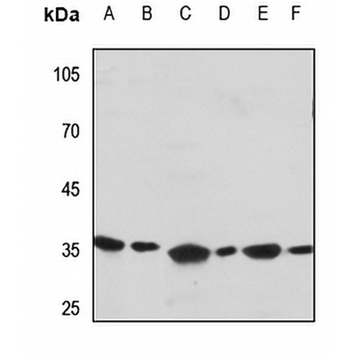 Apolipoprotein E Rabbit Polyclonal Antibody