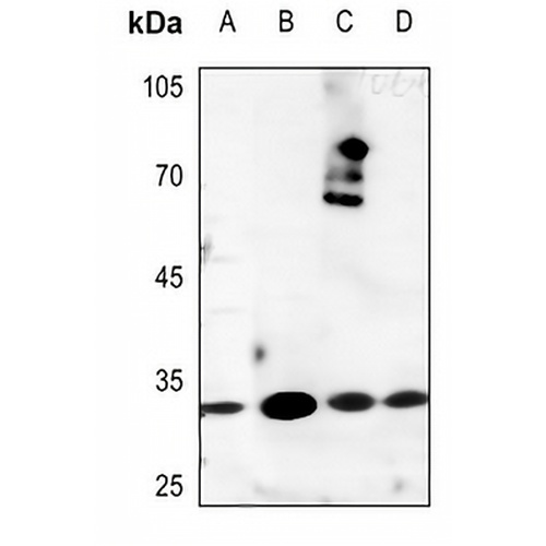 Kallikrein 3 Rabbit Polyclonal Antibody