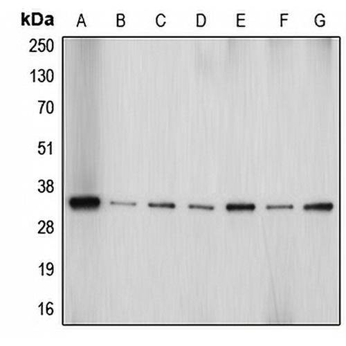Aquaporin 4 Rabbit Polyclonal Antibody