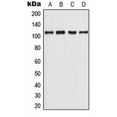 Androgen Receptor (Phospho-Y363) Rabbit Polyclonal Antibody