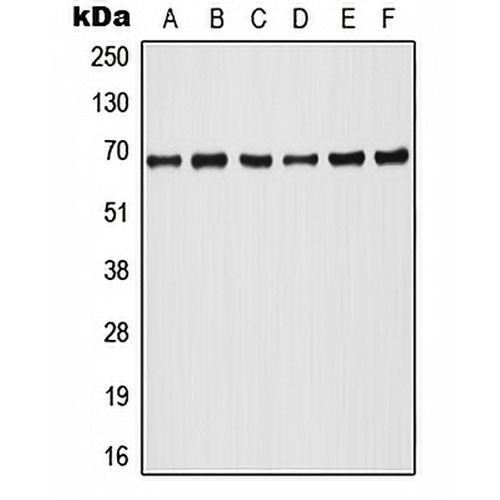 A-RAF (Phospho-Y302) Rabbit Polyclonal Antibody