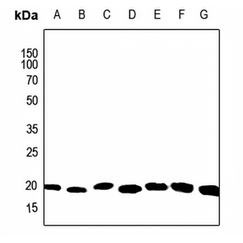 ARF6 Rabbit Polyclonal Antibody