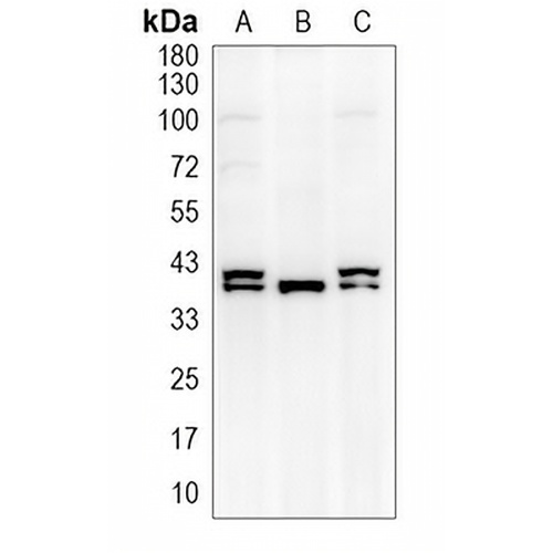 Arginase 1 Rabbit Polyclonal Antibody