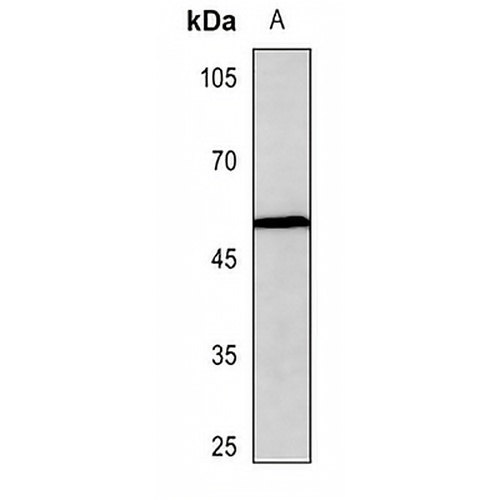 Beta-arrestin-1 (Phospho-S412) Rabbit Polyclonal Antibody