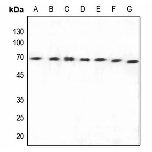 Arylsulfatase E Rabbit Polyclonal Antibody