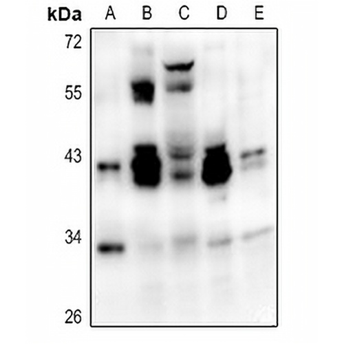 ATF1 Rabbit Polyclonal Antibody