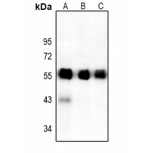 ATF4 Rabbit Polyclonal Antibody