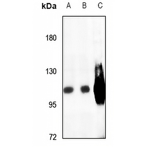 SERCA1 Rabbit Polyclonal Antibody