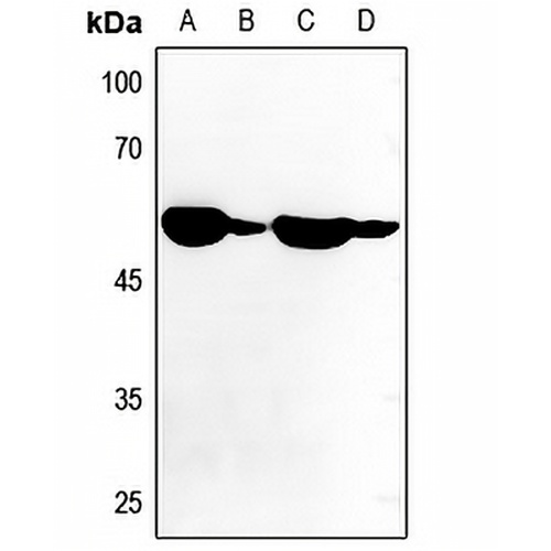 ATP6V1B1 Rabbit Polyclonal Antibody