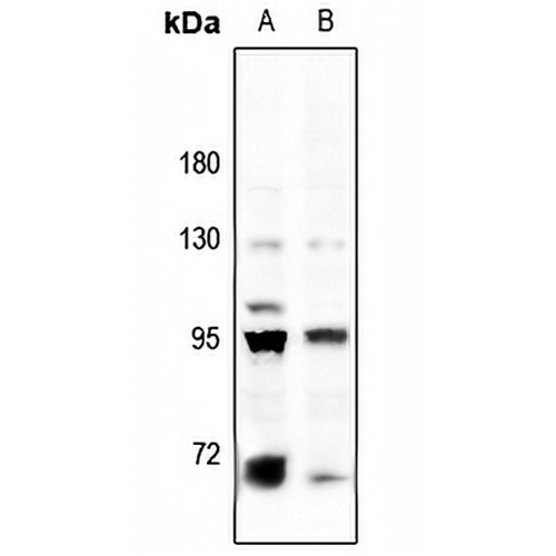 BACH1 Rabbit Polyclonal Antibody