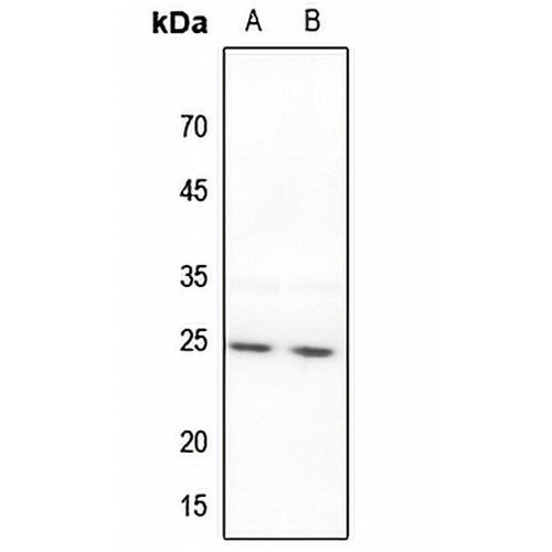 BAK Rabbit Polyclonal Antibody