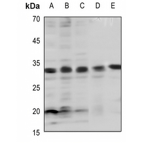 BCL2 (Phospho-T69) Rabbit Polyclonal Antibody