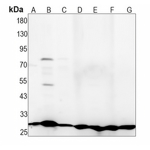 BCL2 Rabbit Polyclonal Antibody