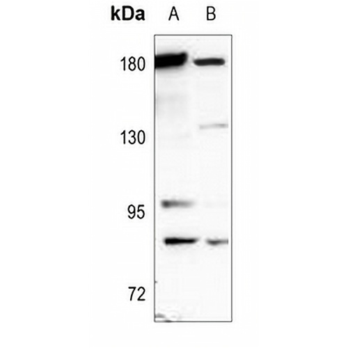 CD66a/e Rabbit Polyclonal Antibody