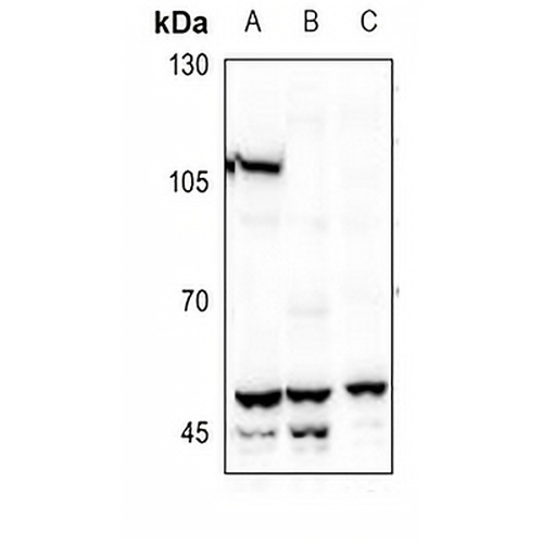 BMP3 Rabbit Polyclonal Antibody