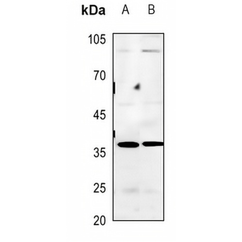 BNIP2 Rabbit Polyclonal Antibody