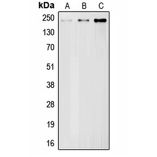 BRCA1 Rabbit Polyclonal Antibody