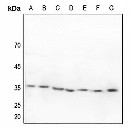 ZFP36L1 Rabbit Polyclonal Antibody