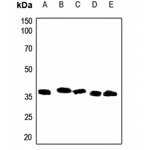 CD157 Rabbit Polyclonal Antibody