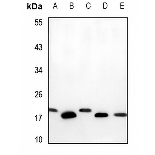 PBR Rabbit Polyclonal Antibody