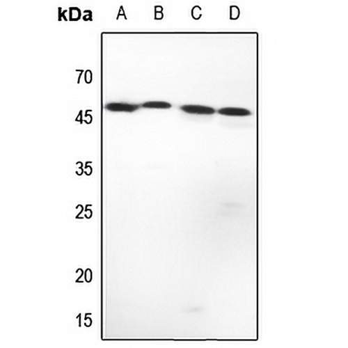 Complement C1R LC Rabbit Polyclonal Antibody