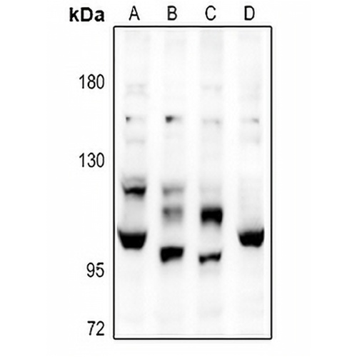 Complement C6 Rabbit Polyclonal Antibody