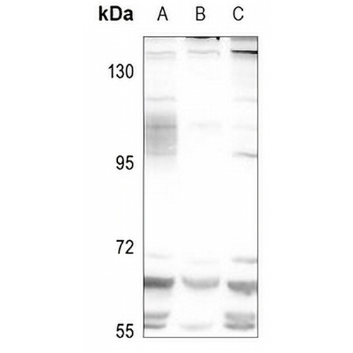 Complement C9 Rabbit Polyclonal Antibody