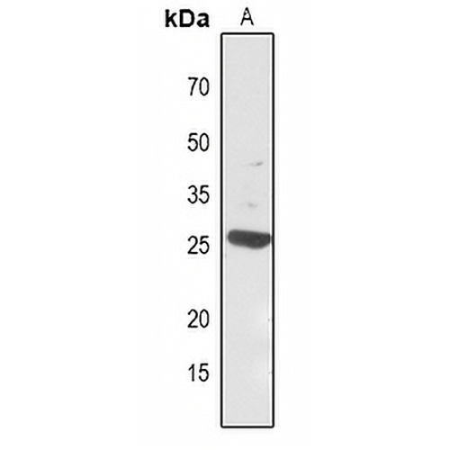 Carbonic Anhydrase 1 Rabbit Polyclonal Antibody