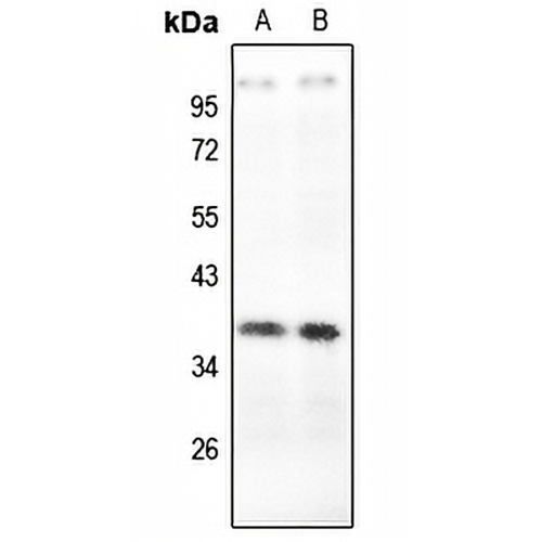 Carbonic Anhydrase 6 Rabbit Polyclonal Antibody