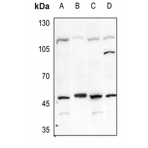 Carbonic Anhydrase 9 Rabbit Polyclonal Antibody