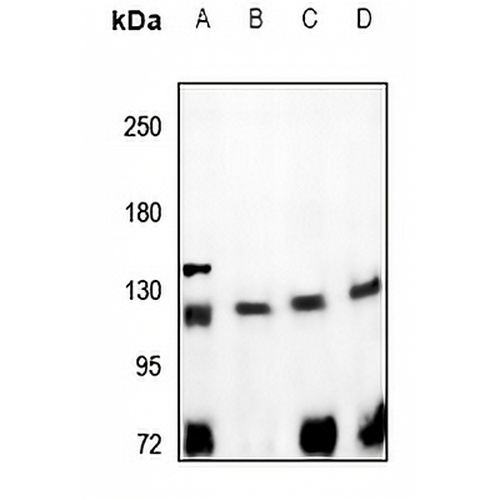 CD167a Rabbit Polyclonal Antibody