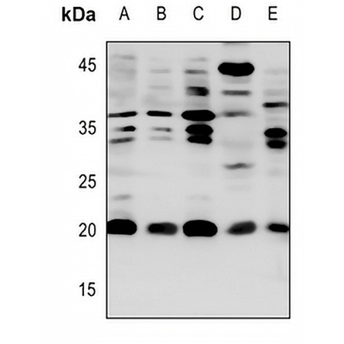 CACNG1 Rabbit Polyclonal Antibody