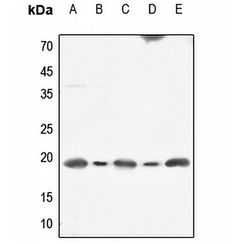 Calmodulin Rabbit Polyclonal Antibody