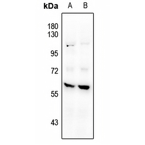 CaMK2 beta Rabbit Polyclonal Antibody