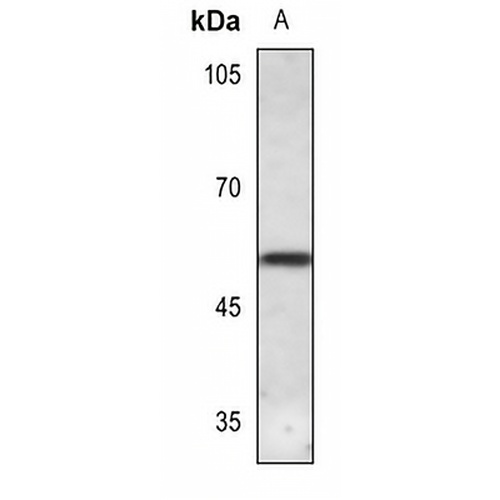 CaMK2 delta Rabbit Polyclonal Antibody