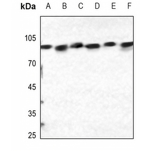 Calnexin (Phospho-S583) Rabbit Polyclonal Antibody