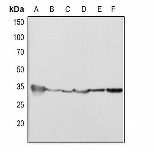Cleaved Caspase 2 Rabbit Polyclonal Antibody