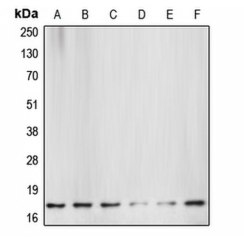 active Caspase 3 Rabbit Polyclonal Antibody