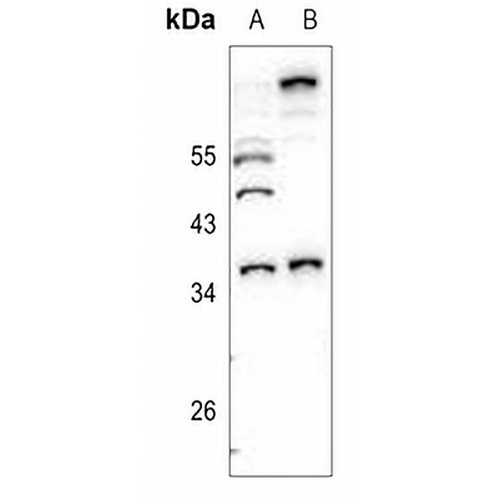 Caspase 7 Rabbit Polyclonal Antibody