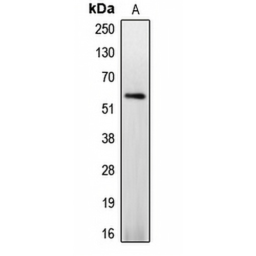 Caspase 8 (Phospho-S347) Rabbit Polyclonal Antibody