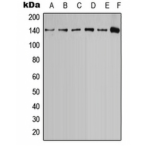 Calcium Sensing Receptor (Phospho-T888) Rabbit Polyclonal Antibody