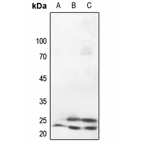 Caveolin 1 Rabbit Polyclonal Antibody