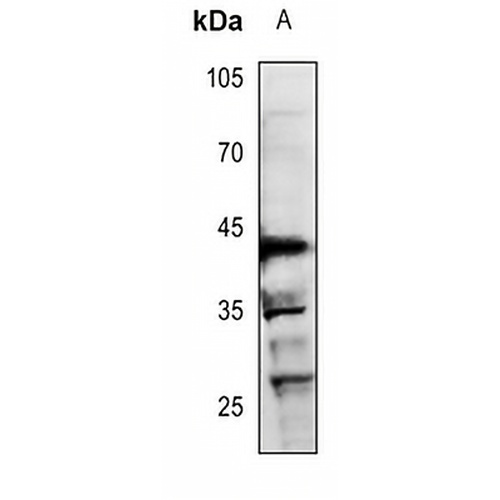 RUNX3 Rabbit Polyclonal Antibody